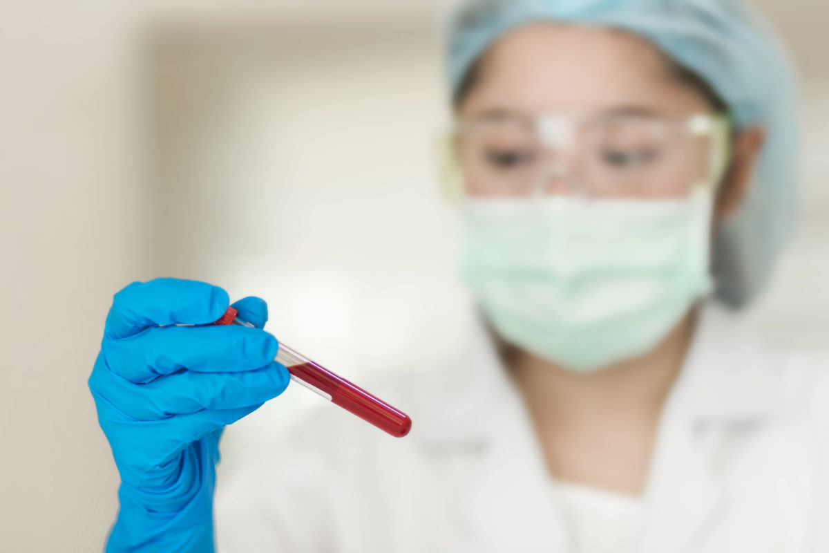 The CancerSEEK test