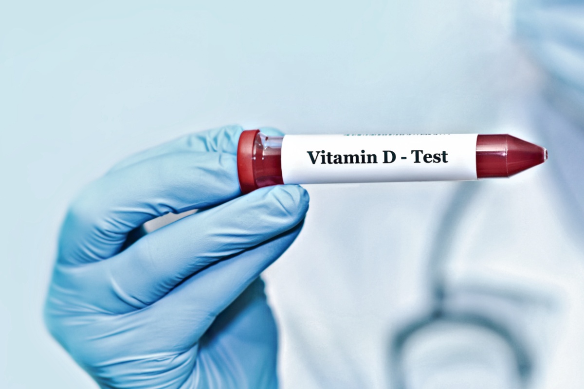 D-vitaminbrist Orsaker symtom och behandling