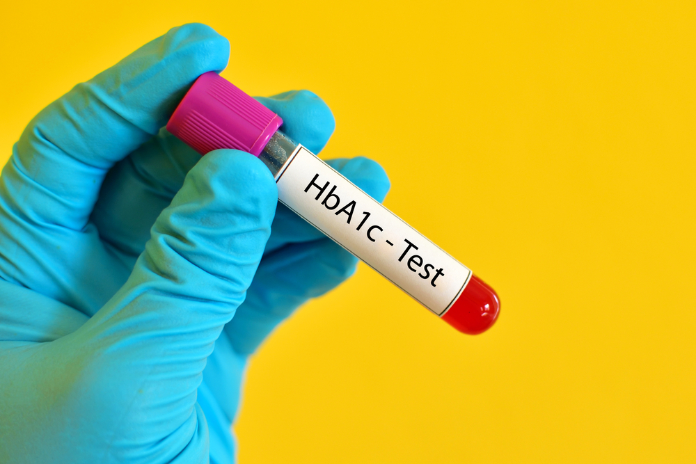 Diabetes och blodprov